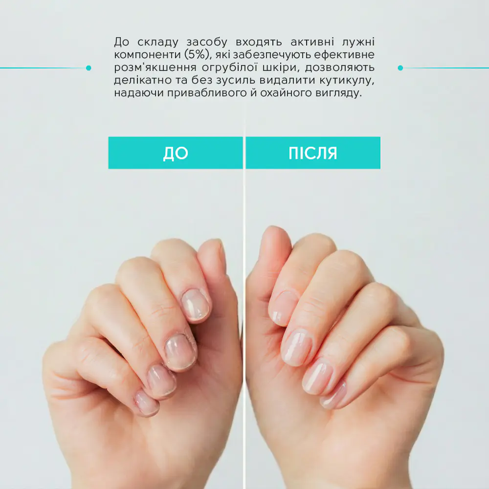 Ремувер для кутикули М'яке лезо Shelly 30 мл - фото 3